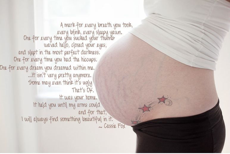 Stretch marks quote