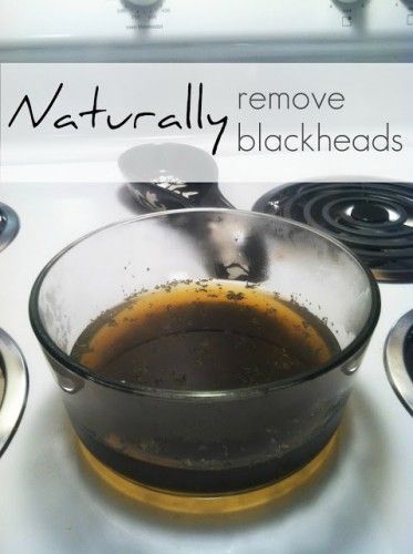 Naturally remove Blackheads