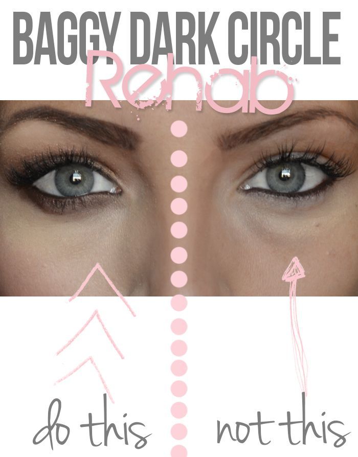 Damage control: The absolute BEST way to diminish baggy under eyes and dark circ