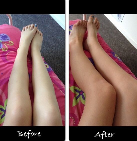 before and after my home made no streak tanning cream If tested, and it lasts fo