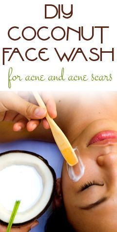 Coconut Face wash for acne and acne scars