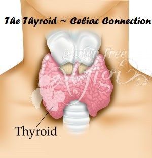 Celiac Disease and Autoimmune Thyroid Disease There is a distinct link between C