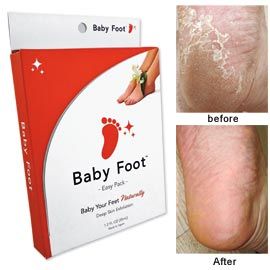 Baby Foot Exfoliation, Smooth Feet, Foot Care, Skin Care | Solutions