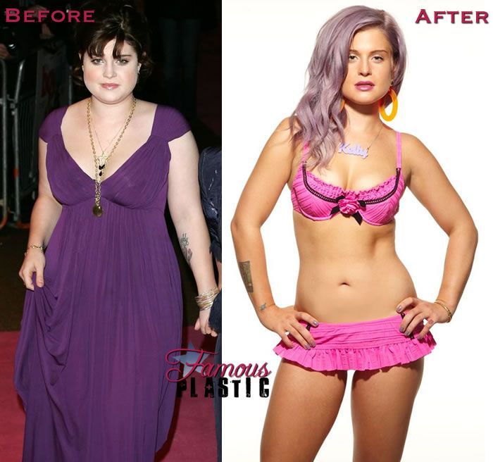 jels — Kelly Osbourne before and after losing 69lbs