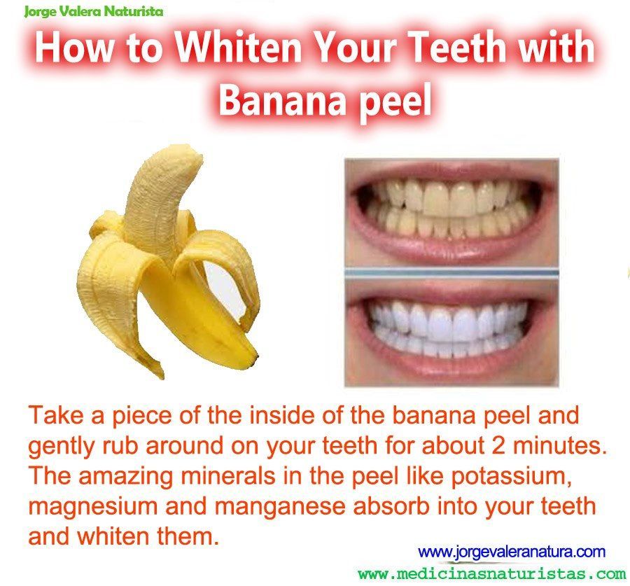 banana teeth whitener ,