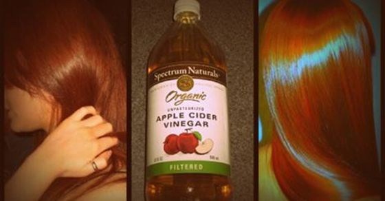 An excellent treatment for the hair and scalp is the unfiltered apple cider vinegar, which is cleansing the hair, giving it more body and luster and also reduces hair loss, itching scalp and