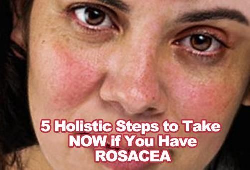 5 Holistic Steps to Take NO
