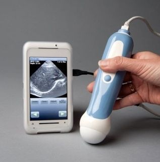 For the next one! This personal ultrasound machine connects directly to your smartphone. | 36 Ingenious Things Youll Want As A