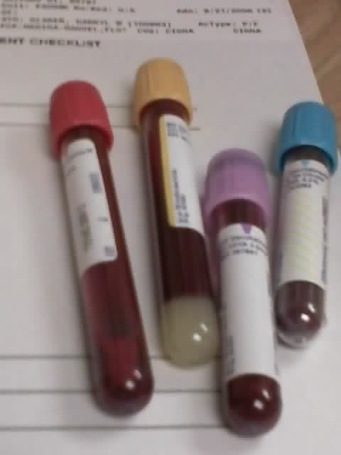 Order of Draw Blood Tubes f
