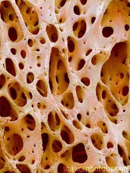 Bone tissue (imaged using a scanning electron microscope [SEM])