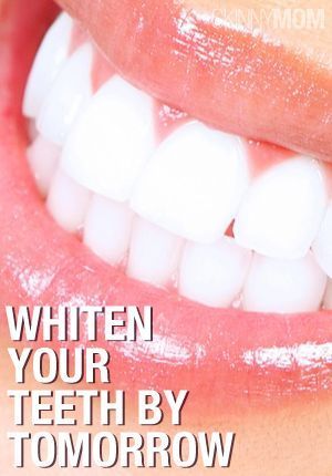 Who doesnt want bright, white teeth?