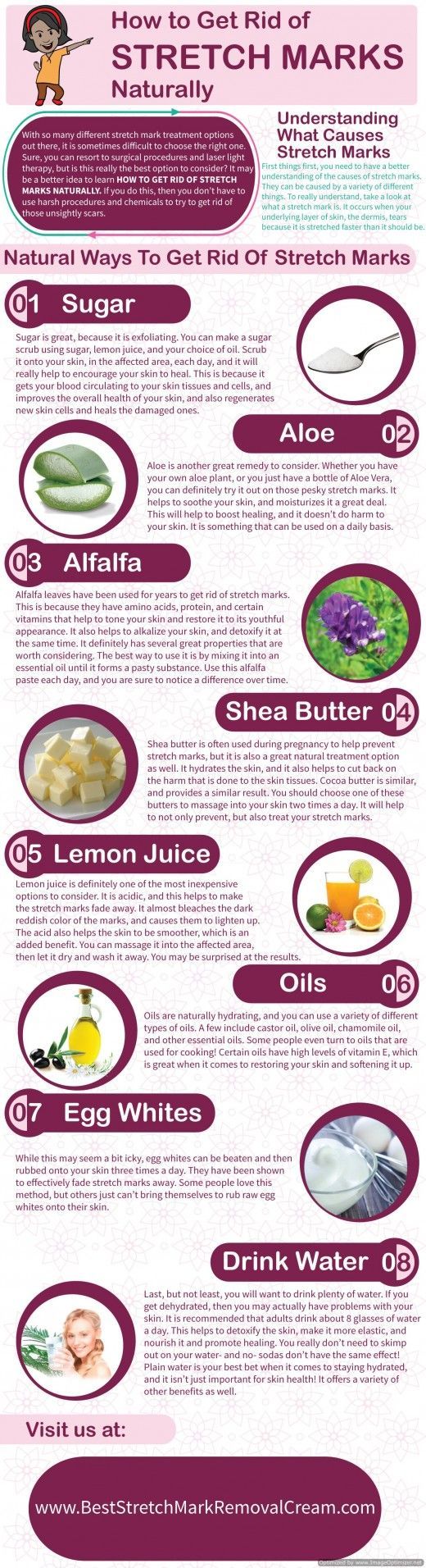 8 Ways to Get Rid of Stretch Marks Naturally …