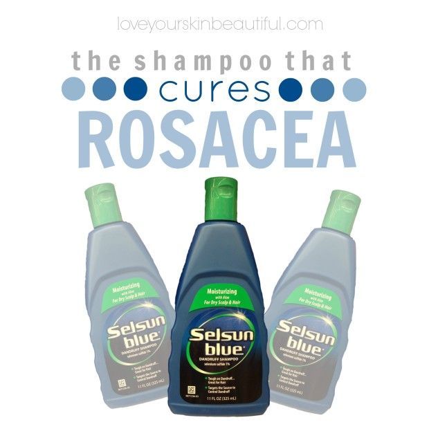 The Shampoo that Cures Rosacea