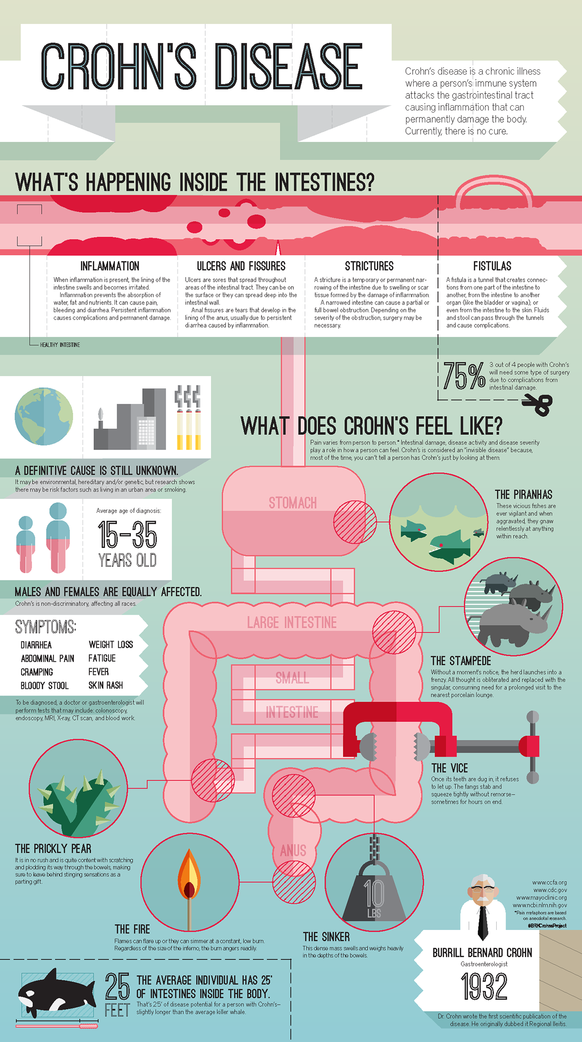 Crohns Disease – An Infographic. by B. R. Keller, via Behance