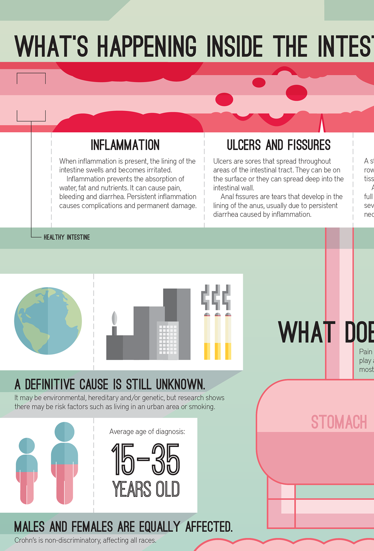 Crohns Disease – An Infographic. by B. R. Keller, via Behance