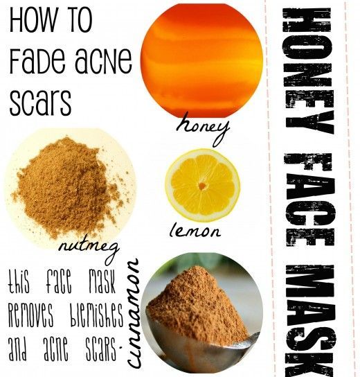 Honey face masks can help you fade acne scars and even out skin discolouration, giving your bright and toned skin.