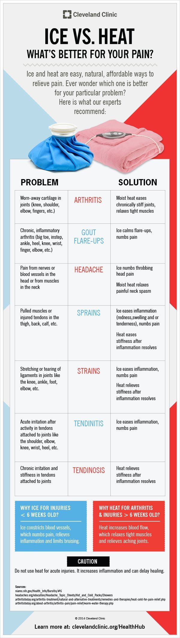 When something hurts, will ice or heat make it feel better? Infographic on HealthHub from Cleveland Clinic