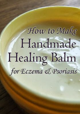 How to Make Handmade Healing Balm for Eczema and Psoriasis – using Neem oil, a fantastic natural remedy for skin complaints