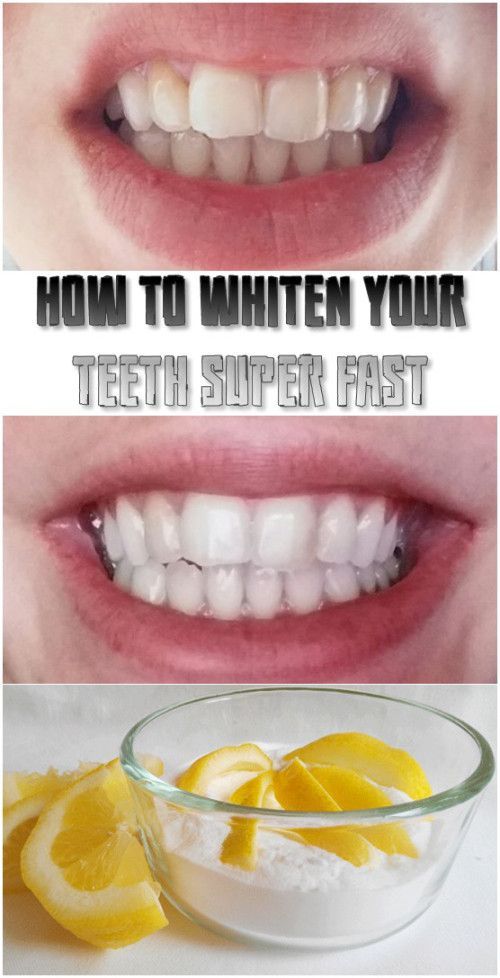 Tips on how to get those perfect pearly whites!