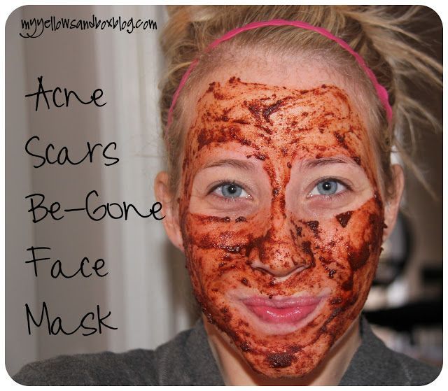 The burning face mask- Natural face mask: nutmeg (anti-inflammatory), cinnamon (