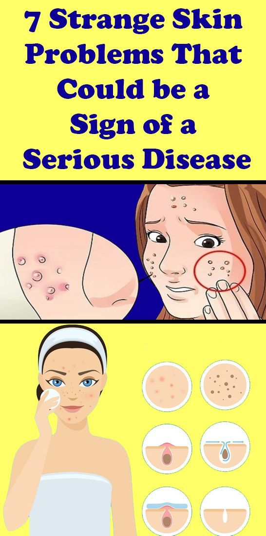 7 Strange Skin Problems That Could be a Sign of a Serious Disease -   13 health and fitness Design ideas