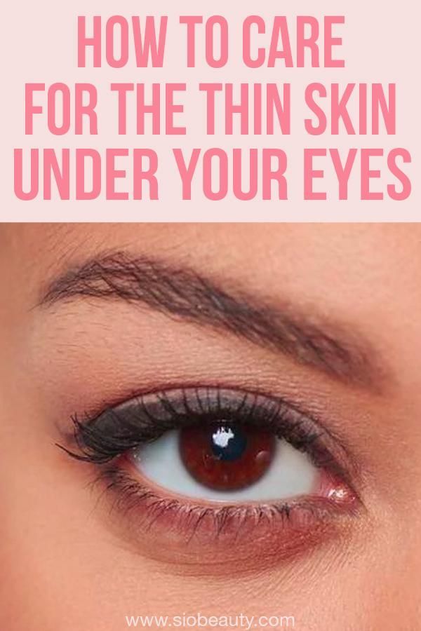 7 Ways To Care For Thin Skin Under Your Eyes -   10 skin care Hacks under eyes ideas