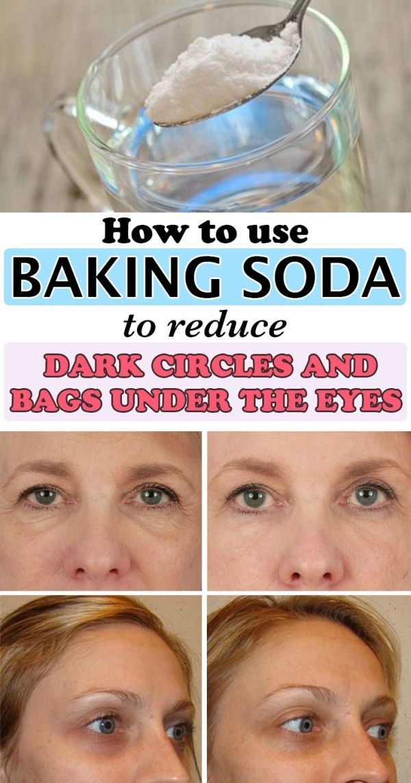 How to use baking soda to reduce dark circles and bags under the eyes - WifeMommyWoman -   10 skin care Hacks under eyes ideas