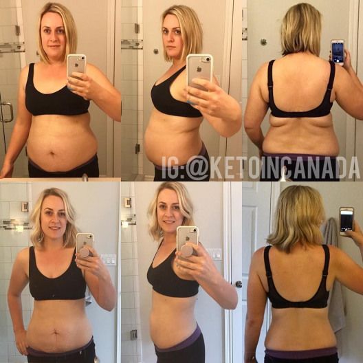 How One Woman Discovered the Female Fat-Loss Code Missed by Modern Medicine And Lost 84lbs Using a Simple 2-Step Ritual That 100% Guarantees Shocking Daily Weight Loss -   12 diet Before And After my life ideas