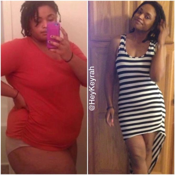 Before And After: Keyrah Uses Vegan Diet To Lose 115 Pounds And Saves Her Life In The Process - African American Weight Loss Success Stories -   12 diet Before And After my life ideas