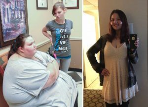24 Before and After Photos from 'My 600 lb.-Life' that Will Make You Regret Regarding Yourself Fat -   12 diet Before And After my life ideas