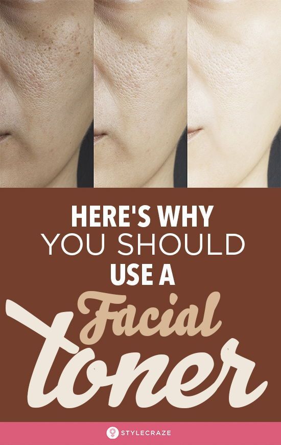 What Does A Toner Do? Why Should You Use A Facial Toner? -   13 skin care Pores facial toner ideas