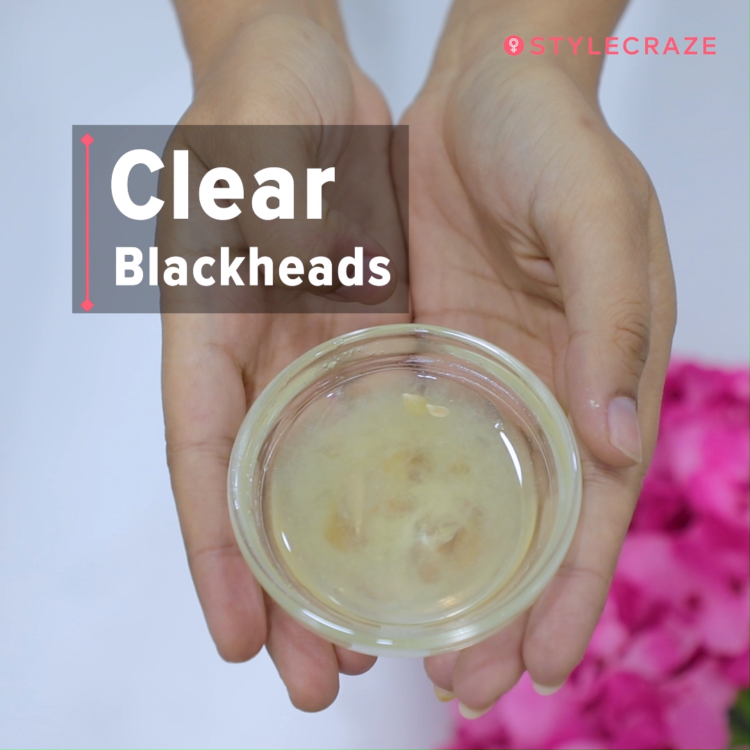 How To Remove Blackheads On The Nose -   17 skin care Homemade how to make ideas