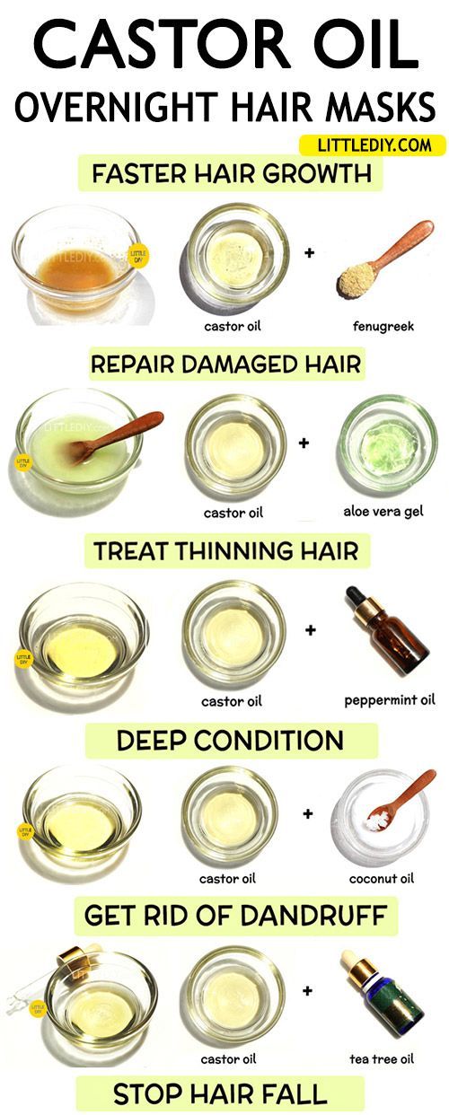 OVERNIGHT CASTOR OIL HAIR TREATMENTS - LITTLE DIY -   14 hair Treatment for dandruff ideas