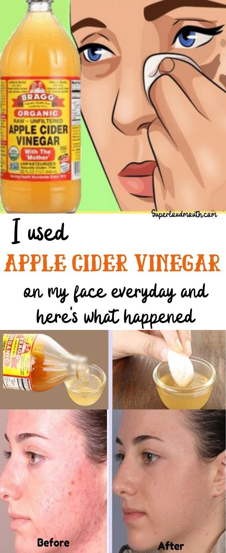 Reasons Why Apple Cider Vinegar Toner Is Getting More Popular In The Past Decade -   21 skin care Face sleep ideas