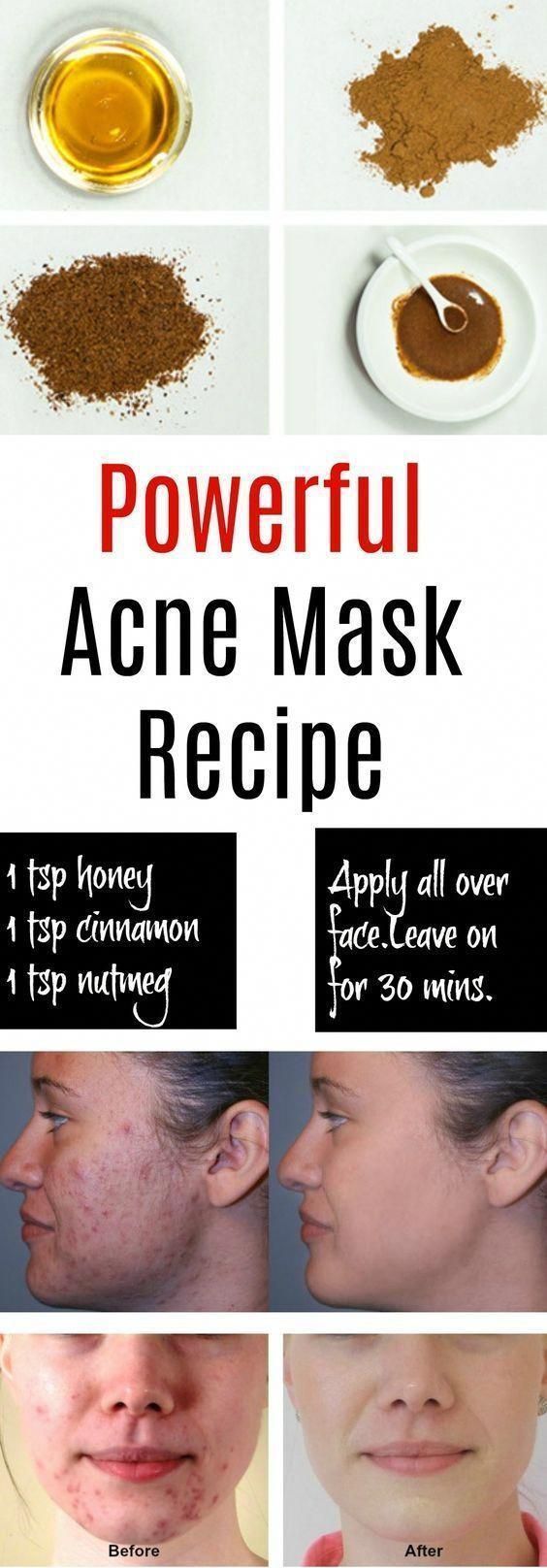 Natural Skin Care Ritual: the 13 Best Ingredients - Dr. Axe -   11 skin care Acne hacks ideas