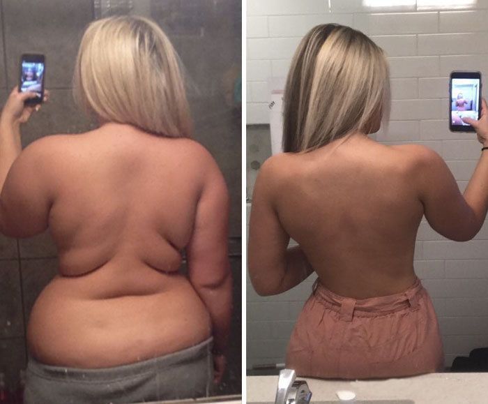 75 people who surprised everyone by losing so much weight they transformed into a whole new person -   8 diet weight loss before and after ideas