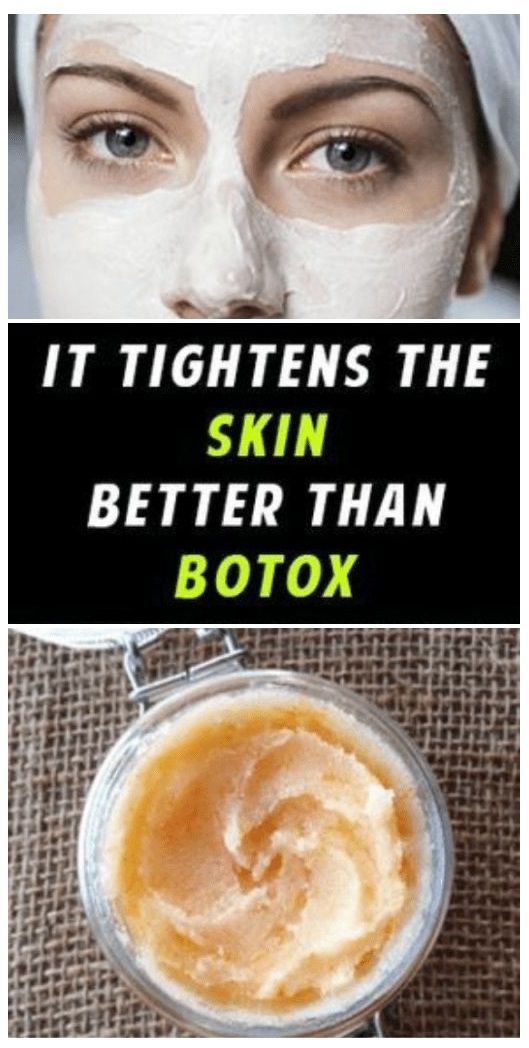 Skin Tightening Homemade Wrinkle Cream That Works Better Than Botox - Blog Like A Lady -   14 skin care For Wrinkles cream ideas