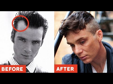 11 GENIUS Hairstyles TO HIDE Receding Hairlines / Big Foreheads (2019 Styles ONLY) -   20 hairstyles For Men with receding hairline ideas