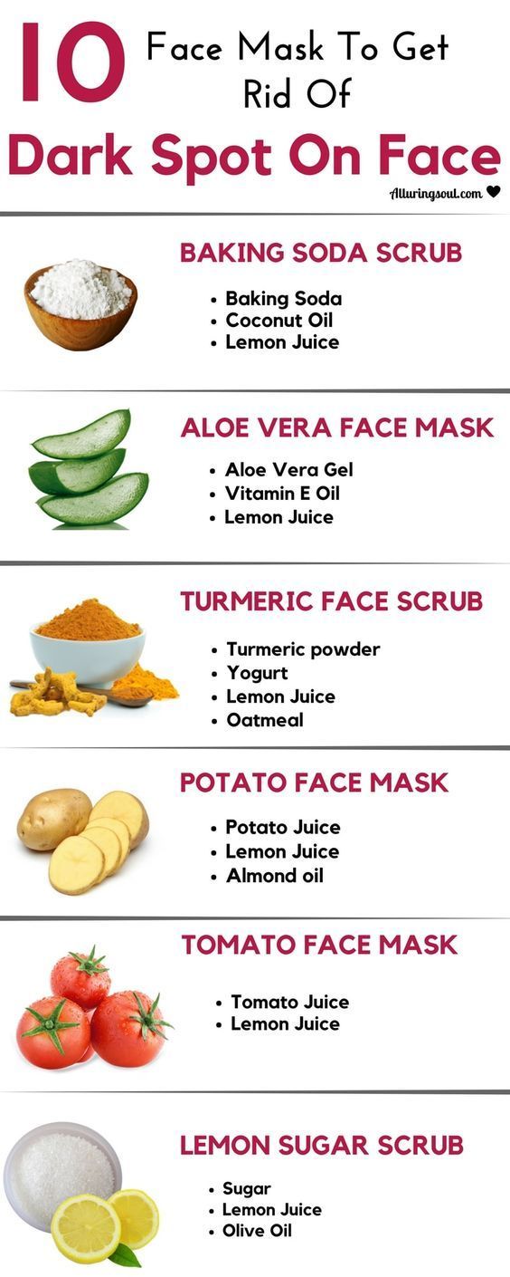 How To Remove Dark Spots On Face - 10 Home Remedies | Alluring Soul -   17 how to get rid of dark spots on face ideas