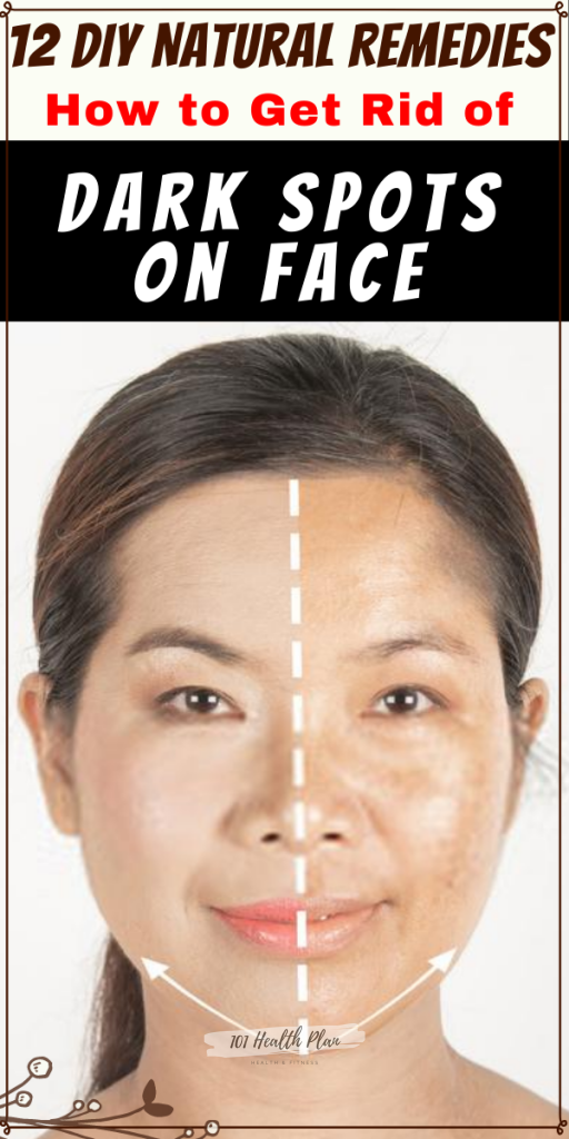 How TO Get Rid of Dark Spots -   17 how to get rid of dark spots on face ideas