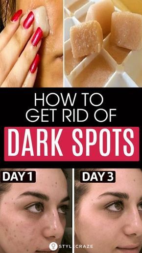 How To Remove Dark Spots On Face Fast: 6 Home Remedies -   17 how to get rid of dark spots on face ideas