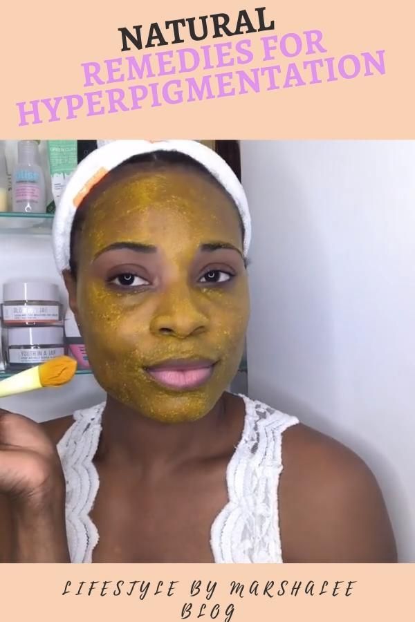 How to get rid of dark spots on your face and body -   17 how to get rid of dark spots on face ideas