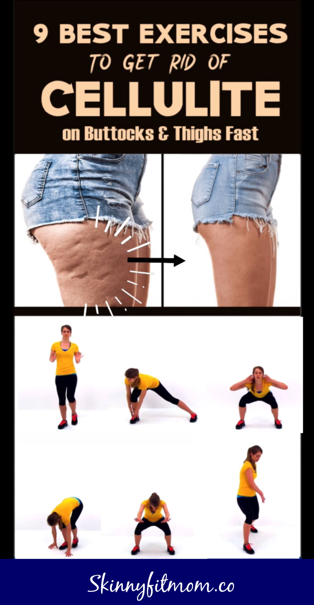 9 Proven Exercise to Getting Rid of Cellulite Fast For a Sexy Legs -   17 how to get rid of stretch marks ideas