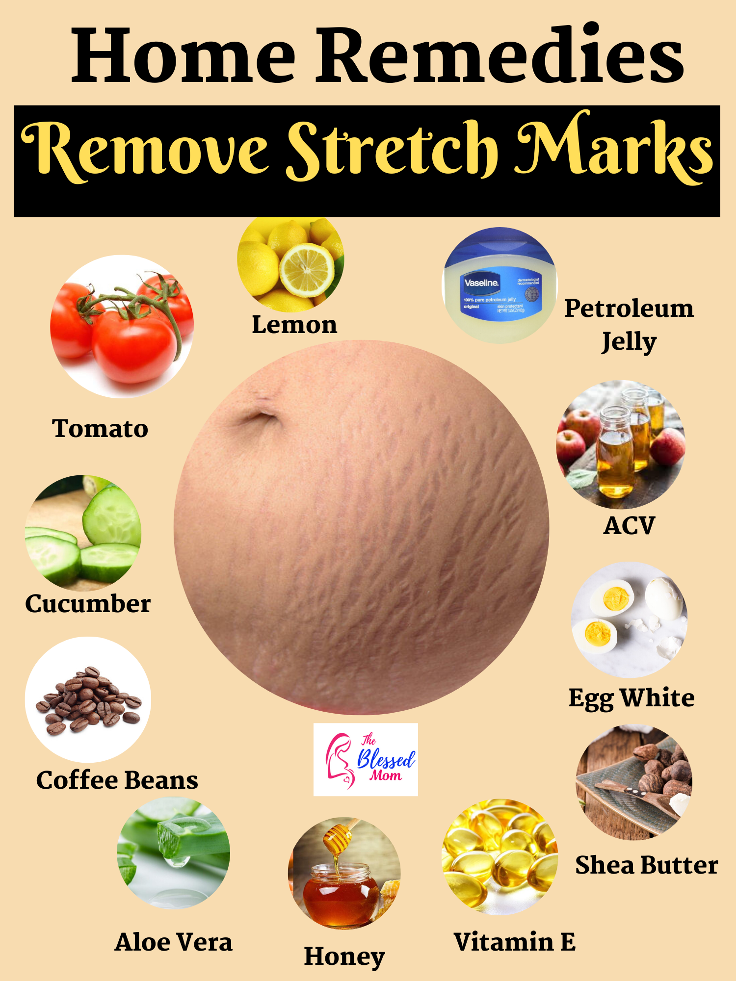 How To Get Rid Of Stretch Marks Naturally ( Causes+ Home Remedies) -   17 how to get rid of stretch marks ideas