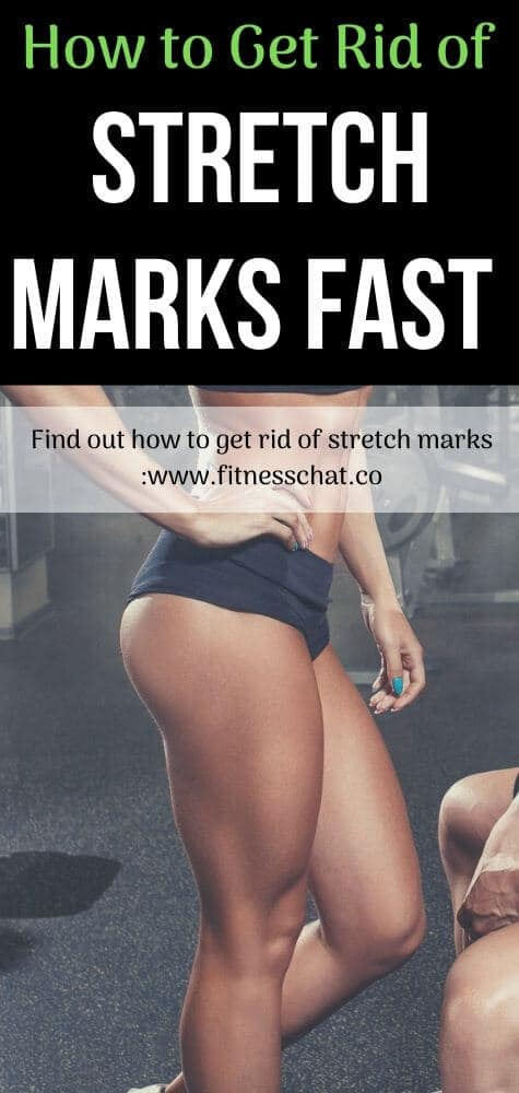 3 Best Ways To Get Rid Of Stretch Marks -   17 how to get rid of stretch marks ideas