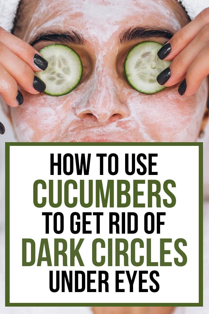 How to Get Rid of Dark Circles Under Eyes: DIY Home Remedies -   18 how to get rid of dark circles under eye ideas