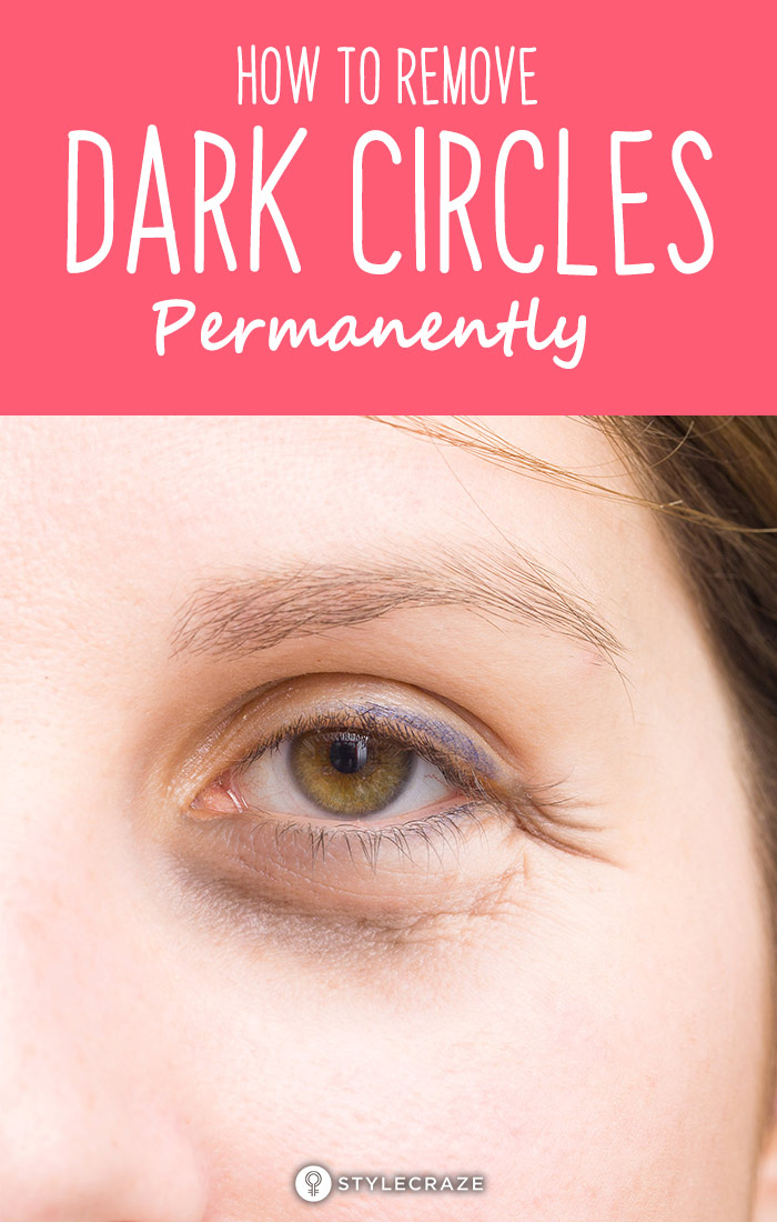 13 Ways To Get Rid of Dark Circles Under The Eyes -   18 how to get rid of dark circles under eye ideas