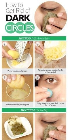 How to remove dark circles under eyes at home | dark circles under eyes overnight -   18 how to get rid of dark circles under eye ideas