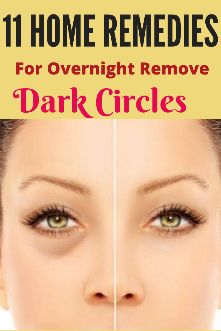 11 Best Home Remedies For Overnight Remove dark circles at home -   18 how to get rid of dark circles under eye ideas
