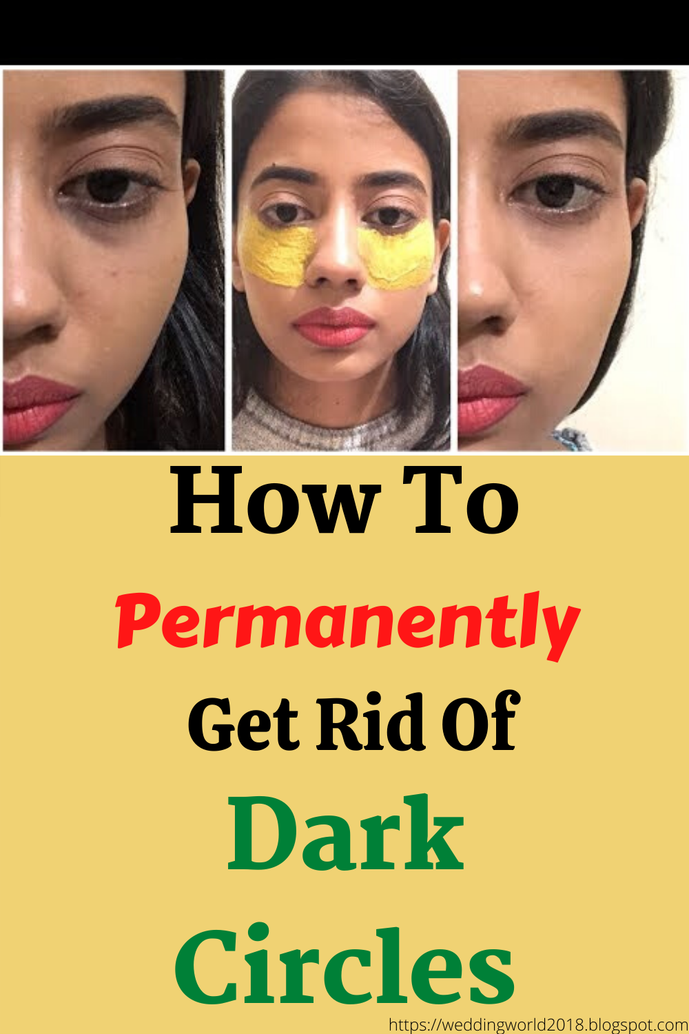 How to Permanently Get Rid of Dark Circles -   18 how to get rid of dark circles under eye ideas